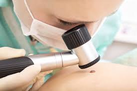symptoms of moles